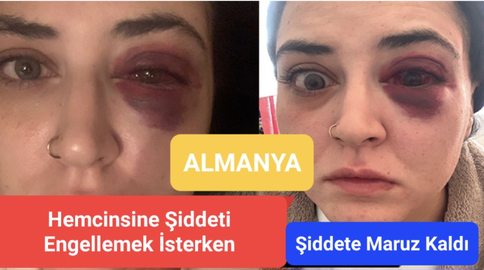 Almanya’da Hemcinsine Şiddete Engel Olmak İsterken Darp Edildi.