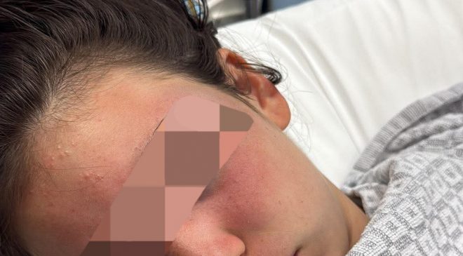 13 Yaşındaki Türk Kız Çocuğu, Havuzda Öldüresiye Dövüldü.