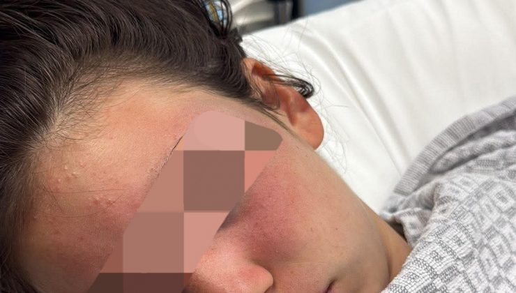 13 Yaşındaki Türk Kız Çocuğu, Havuzda Öldüresiye Dövüldü.