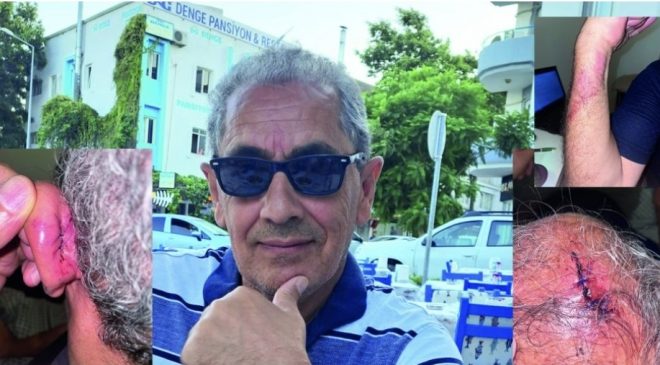 Gurbetçi Vatandaş Saldırıya Uğradı, Saldırgan Serbest Bırakıldı.