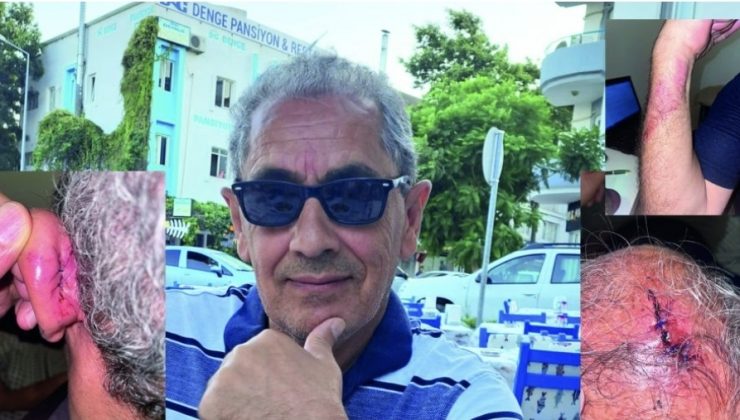 Gurbetçi Vatandaş Saldırıya Uğradı, Saldırgan Serbest Bırakıldı.