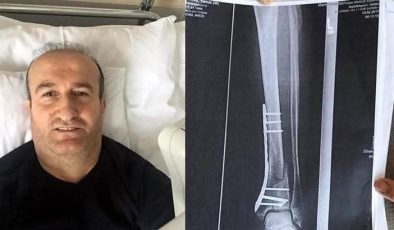 Türkiye’de çukura düşen gurbetçi vatandaşa 1 milyon TL tazminat verildi. Kazazede karara isyan etti.