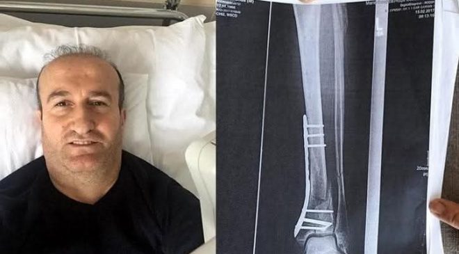 Türkiye’de çukura düşen gurbetçi vatandaşa 1 milyon TL tazminat verildi. Kazazede karara isyan etti.