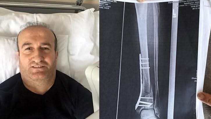 Türkiye’de çukura düşen gurbetçi vatandaşa 1 milyon TL tazminat verildi. Kazazede karara isyan etti.